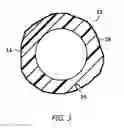 Fig. 04 - Vented Sound Attenuation Earplug System