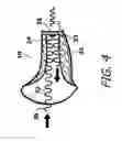 Fig. 05 - Vented Sound Attenuation Earplug System