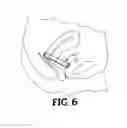 Fig. 04 - Cervical pad