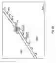 Fig. 17 - NEGATIVE PRESSURE WOUND CLOSURE DEVICE