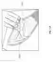 Fig. 24 - NEGATIVE PRESSURE WOUND CLOSURE DEVICE