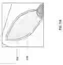 Fig. 25 - NEGATIVE PRESSURE WOUND CLOSURE DEVICE