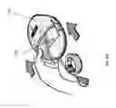 Fig. 34 - NEGATIVE PRESSURE WOUND CLOSURE DEVICE