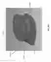 Fig. 54 - NEGATIVE PRESSURE WOUND CLOSURE DEVICE