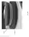 Fig. 57 - NEGATIVE PRESSURE WOUND CLOSURE DEVICE