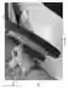 Fig. 58 - NEGATIVE PRESSURE WOUND CLOSURE DEVICE