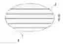 Fig. 64 - NEGATIVE PRESSURE WOUND CLOSURE DEVICE
