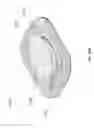 Fig. 71 - NEGATIVE PRESSURE WOUND CLOSURE DEVICE