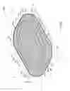 Fig. 72 - NEGATIVE PRESSURE WOUND CLOSURE DEVICE