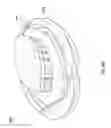 Fig. 74 - NEGATIVE PRESSURE WOUND CLOSURE DEVICE