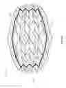 Fig. 75 - NEGATIVE PRESSURE WOUND CLOSURE DEVICE