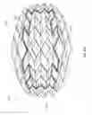 Fig. 77 - NEGATIVE PRESSURE WOUND CLOSURE DEVICE