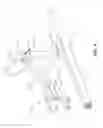 Fig. 06 - Extremity stabilization apparatus