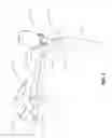 Fig. 10 - Extremity stabilization apparatus