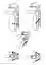 Fig. 16 - Extremity stabilization apparatus