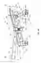 Fig. 50 - Extremity stabilization apparatus