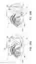 Fig. 22 - Systems and methods for decompression, elliptical traction, and linear traction of the occiput, cervical spine, and thoracic spine