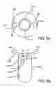 Fig. 06 - Multi-faceted tissue therapy tool