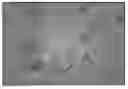 Fig. 01 - Foamable vehicles and pharmaceutical compositions comprising aprotic polar solvents and uses thereof