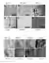Fig. 08 - CAPSULES AND PARTICLES AND USES THEREOF