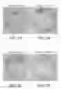 Fig. 03 - Topical formulation and method for preventing or treating acne