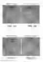 Fig. 04 - Topical formulation and method for preventing or treating acne