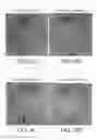Fig. 06 - Topical formulation and method for preventing or treating acne