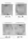 Fig. 07 - Topical formulation and method for preventing or treating acne