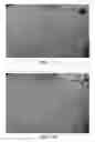 Fig. 08 - Topical formulation and method for preventing or treating acne