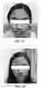Fig. 09 - Topical formulation and method for preventing or treating acne