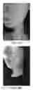 Fig. 10 - Topical formulation and method for preventing or treating acne