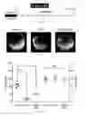 Fig. 05 - Glutarate compounds for treating ischemia-reperfusion injuries