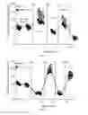 Fig. 06 - Glutarate compounds for treating ischemia-reperfusion injuries