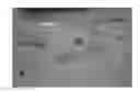 Fig. 01 - Pharmaceutical compositions and uses directed to lysosomal storage disorders
