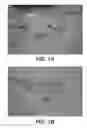 Fig. 02 - Pharmaceutical compositions and uses directed to lysosomal storage disorders