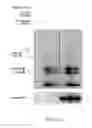 Fig. 03 - Method for Treating or Preventing Fatty Acid Binding Protein 3 Induced B-amyloid Aggregation Diseases