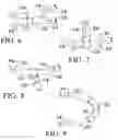 Fig. 06 - Apparatus and Methods for Preventing or Treating Failure of Hemodialysis Vascular Access and Other Vascular Grafts