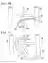 Fig. 07 - Apparatus and Methods for Preventing or Treating Failure of Hemodialysis Vascular Access and Other Vascular Grafts