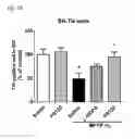 Fig. 06 - Method for preventing or treating movement disorders with lactic acid bacterium