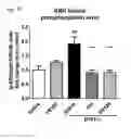 Fig. 13 - Method for preventing or treating movement disorders with lactic acid bacterium