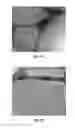 Fig. 02 - NANOPARTICLES FOR DERMAL AND SYSTEMIC DELIVERY OF DRUGS