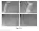 Fig. 08 - NANOPARTICLES FOR DERMAL AND SYSTEMIC DELIVERY OF DRUGS