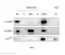 Fig. 09 - Treating infections using IdsD from 