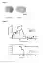 Fig. 03 - Methods of treating malignant tumour with IL-12 and anti-PD-1 antibody