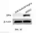 Fig. 04 - Methods and Compositions for Treating Cancers by Inhibiting Estrogen Signaling in Myeloid-Derived Suppressor Cells