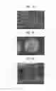 Fig. 02 - Method for preparing microcarriers, microcarriers, and application thereof