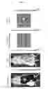 Fig. 07 - Cytotoxic particles for targeting P2X7 receptor