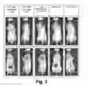 Fig. 05 - Drug delivery system based on JCV-VLP