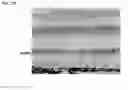 Fig. 87 - Compositions and methods for treating CEP290-associated disease