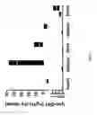 Fig. 04 - Use of lyso-Gb1 as druggable target